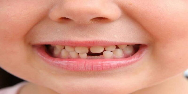 Nhiều cái răng gãy nối tiếp nhau trong giấc chiêm bao